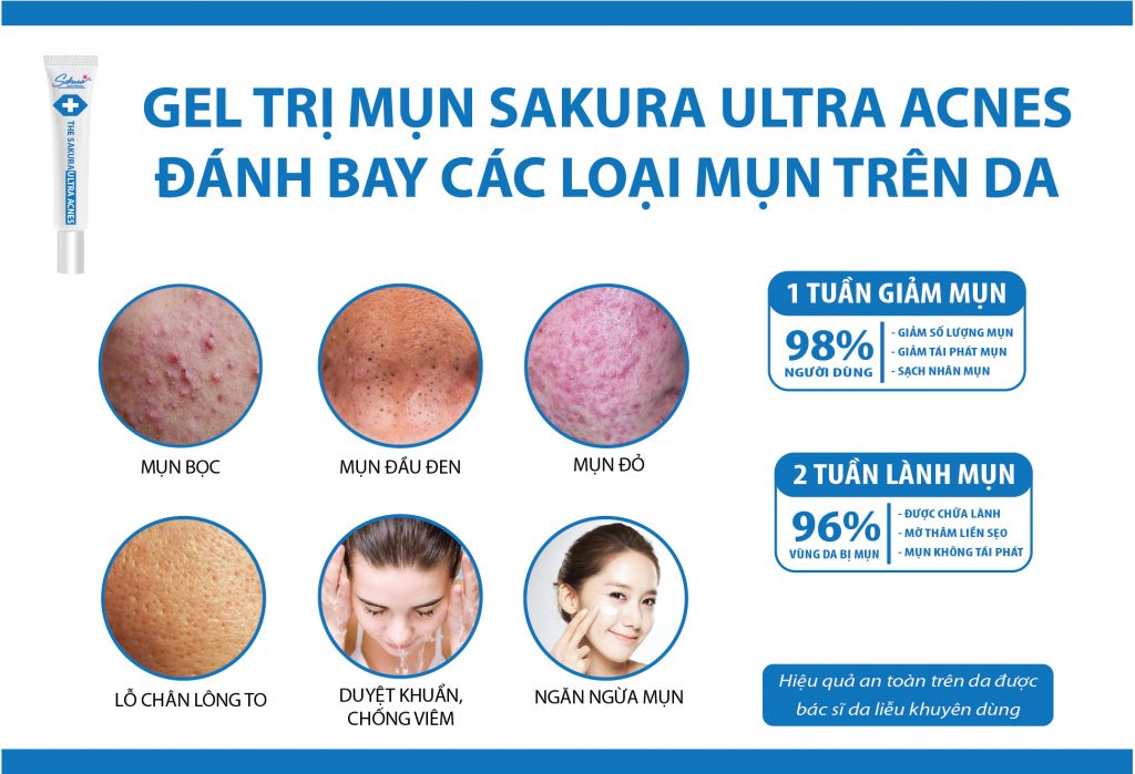 tri-mụn-sakura-acnes