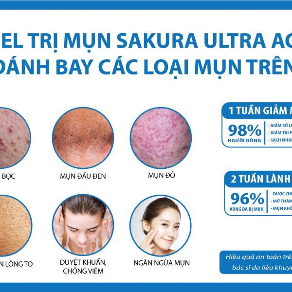 tri-mụn-sakura-acnes